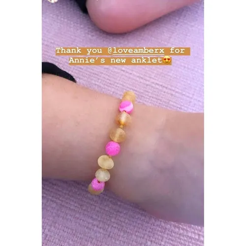 Child Nurture Raw Honey Pink Bead Dragon Agate Baltic Amber Anklet Bracelet